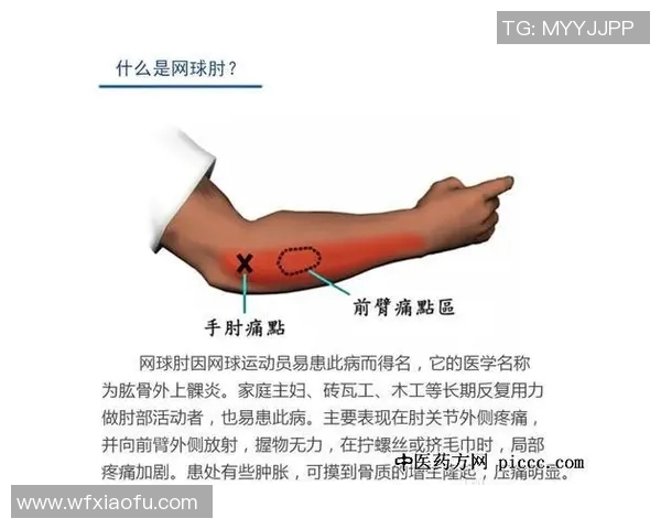 北京网球队战术解析与训练策略探讨聚焦网球竞技提升之路